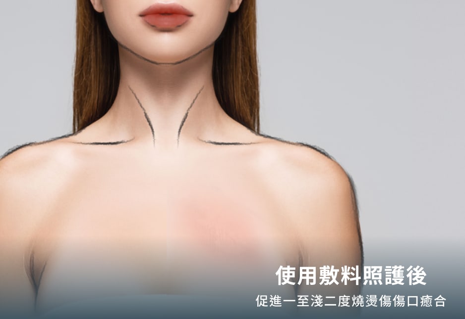創勝傷口敷料-使用敷料照護後